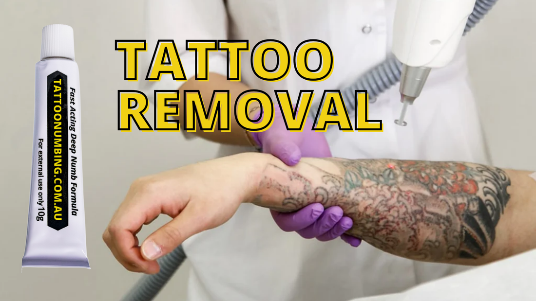 You Thought Getting a Tattoo Hurt? Try Getting One Removed.