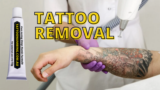 You Thought Getting a Tattoo Hurt? Try Getting One Removed.